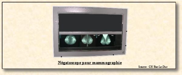 negatoscope