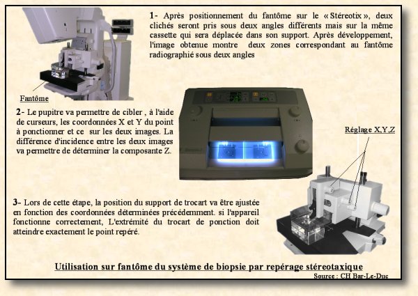 stereo fantome