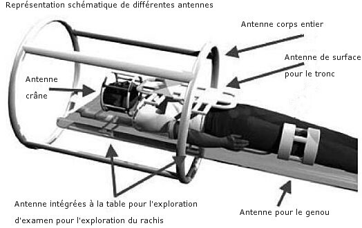 Schéma des différentes antennes