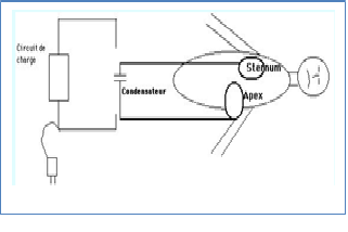 illustration des electrodes