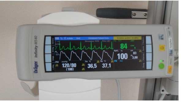 Modulemoniteur