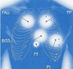 Foyer d'oscultation du coeur et du thorax