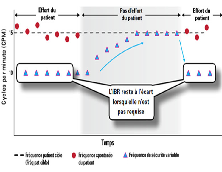 La technologie du Stellar 150 le iVAPS